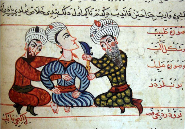 A complex surgical method at the House of Wisdom in Baghdad