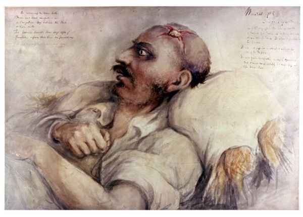 British Army surgeon Charles Bell painted graphic pictures of those wounded in battle