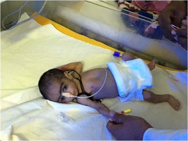 Paediatric ward, Mithi - a prematurely born twin